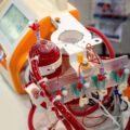 CG Series Clamp-on Ultrasonic Flow Sensors for Medical Devices