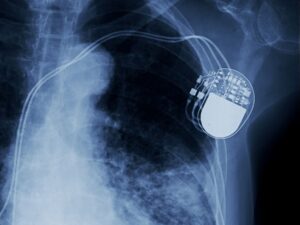 Trelleborg Medical Solutions polymer components and custom assemblies for cardiology devices such as pacemakers and heart valves